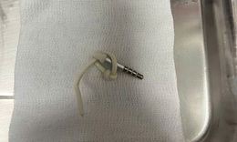 Xem clip sex tìm khoái lạc trên mạng, nam thanh niên nhập viện vì nhét dây tai nghe 10cm vào “cậu nhỏ”