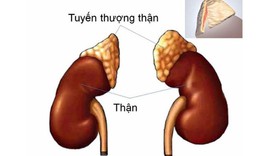 Hội chứng Cushing: Nguyên nhân, biểu hiện, cách điều trị và phòng bệnh