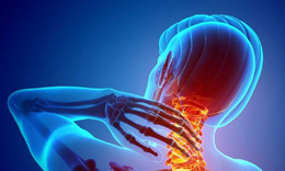 Hội chứng đầu cổ: Nguyên nhân, biểu hiện, cách điều trị và phòng bệnh