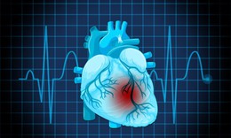 Dấu hiệu cảnh báo rối loạn nhịp tim