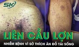 Người đàn ông nhiễm liên cầu lợn vì sở thích ăn tiết canh, đồ tái sống