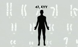 Hội chứng XYY: Nguyên nhân, biểu hiện, cách điều trị và phòng bệnh