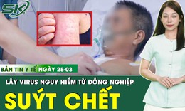 Bản tin Y tế 28/3: Người đàn ông trẻ suýt chết vì lây virus nguy hiểm từ đồng nghiệp