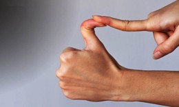 Hội chứng ehlers-danlos: Nguyên nhân, biểu hiện, cách điều trị và phòng bệnh
