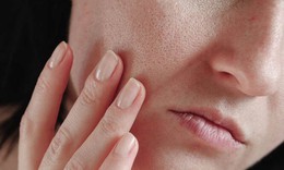 Da dầu có lão hóa chậm hơn da khô?