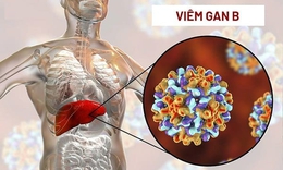 Nguy cơ suy gan nếu tự bỏ thuốc điều trị viêm gan B