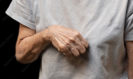 6 câu hỏi thường gặp liên quan đến hội chứng Volkmann