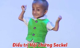 Câu hỏi thường gặp liên quan đến hội chứng seckel