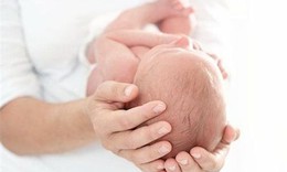 Câu hỏi thường gặp liên quan đến hội chứng Crouzon
