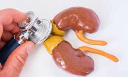Câu hỏi thường gặp liên quan đến hội chứng Cushing