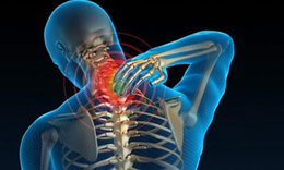 Câu hỏi thường gặp liên quan đến bệnh thoái hóa cột sống cổ
