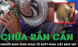 Chữa rắn cắn bằng thuốc nam, người đàn ông suýt mất bàn tay