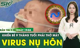 Bản Tin Y Tế 19/4: Bé 9 tháng nguy kịch phải thở máy vì nhiễm virus từ nụ hôn của người lớn