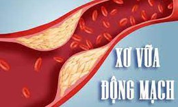 Một số thuốc và phương pháp điều trị xơ vữa động mạch
