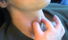Câu hỏi thường gặp liên quan đến bệnh liệt cơ mở thanh quản