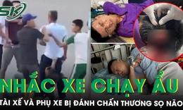 Hạ kính nhắc nhở xe khác chạy ẩu, tài xế và phụ xe ở Nghệ An bị đánh chấn thương sọ não