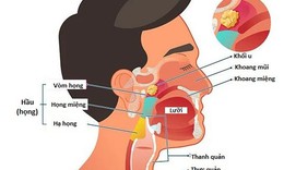 Ung thư đầu và cổ - Những điều nên biết