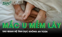 Nam thanh niên mắc u mềm lây sau quan hệ tình dục không an toàn