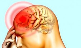 Những dấu hiệu thiếu máu não