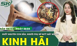 Bản tin Y tế 6/4: Nuốt nguyên con rắn, người phụ nữ tắc ruột vì hàng trăm mảnh xương