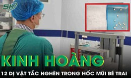 Gắp 12 dị vật mắc trong hốc mũi bé trai 3 tuổi