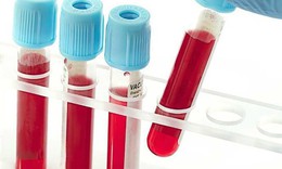 Thuốc điều trị Hội chứng Evans