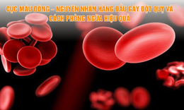Cục máu đông – Nguyên nhân và cách phòng ngừa hiệu quả