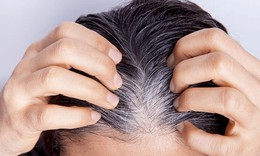 Làm gì để cải thiện tóc bạc sớm, rụng tóc?
