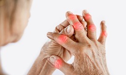 Biểu hiện cảnh báo khởi phát bệnh gút