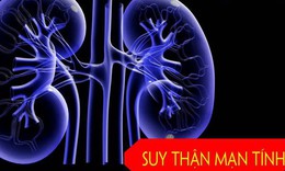 Các phương pháp điều trị suy thận mạn tính
