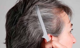 Rụng tóc tuổi già và cách khắc phục