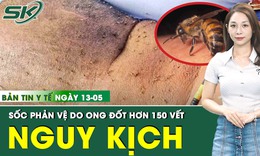 Bản tin Y tế 13/5: Bị ong đốt hơn 150 vết, người đàn ông sốc phản vệ, nguy kịch tính mạng