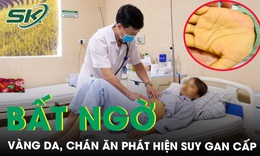 Da vàng như nghệ, ăn uống kém, bất ngờ phát hiện suy gan cấp, nguy cơ lây cao