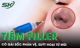 Tiêm filler, cô gái sốc phản vệ, suýt hoại tử mũi