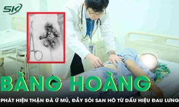 Đau lưng nhưng chủ quan, người phụ nữ không ngờ thận đã ứ mủ, đầy sỏi san hô