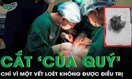 Từ một vết loét, người đàn ông phải cắt toàn bộ 'của quý' vì ung thư dương vật