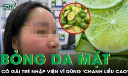 Cô gái 25 tuổi bỏng da mặt, sưng nề vì dùng 'chanh liều cao' trị mụn
