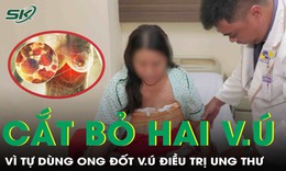 Tự dùng ong đốt vú điều trị ung thư, người phụ nữ phải cắt bỏ hai vú vì di căn