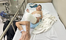 Con lớn bị tâm thần, người cha nghèo cầu cứu cộng đồng để điều trị cho con trai út mắc bệnh hiếm gặp