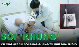 Phẫu thuật lấy viên sỏi bàng quang kích thước "khủng" như quả trứng gà cho cụ ông 98 tuổi