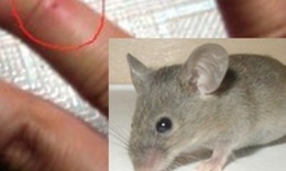 Những bệnh có thể lây nhiễm từ chuột và cách phòng