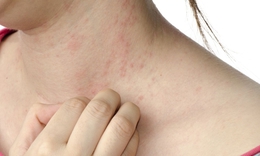 6 dấu hiệu cảnh báo gan bị nhiễm độc bạn đã biết chưa?