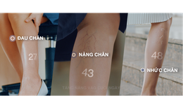Điều trị hiệu quả triệu chứng suy giãn tĩnh mạch từ chiết xuất vỏ cam non