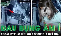 Bé gái 10 tuổi đau bụng âm ỉ, đi khám mới biết có hai tử cung, một quả thận