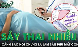Bác sĩ cảnh báo hội chứng lạ khiến sản phụ 33 tuổi nhiều lần sảy thai, bụng to nhanh