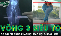 Vòng ba siêu to, cô gái trẻ phát hiện mắc hội chứng cực hiếm