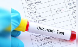Người tăng axit uric cần tránh loại thực phẩm nào?