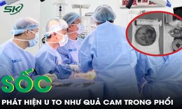 Sốc nặng khi phát hiện khối u to như quả cam trong phổi