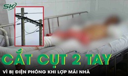 Bị điện ph&#243;ng l&#250;c lợp m&#225;i nh&#224;, người đ&#224;n &#244;ng trả gi&#225; đắt khi phải cắt cụt 2 tay