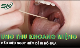 Ung thư khoang miệng: Dấu hiệu nguy hiểm dễ bị bỏ qua